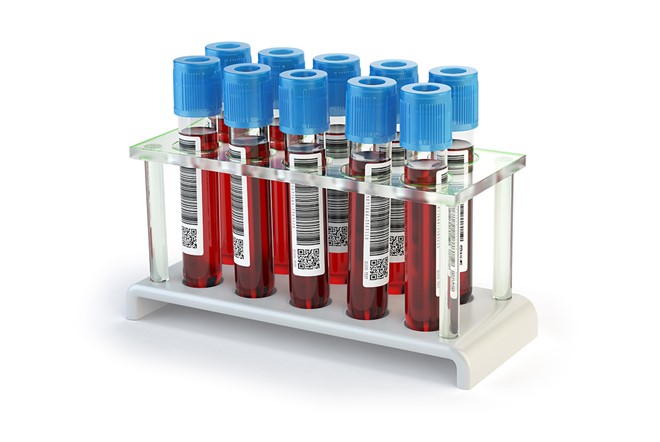 Blood Tests